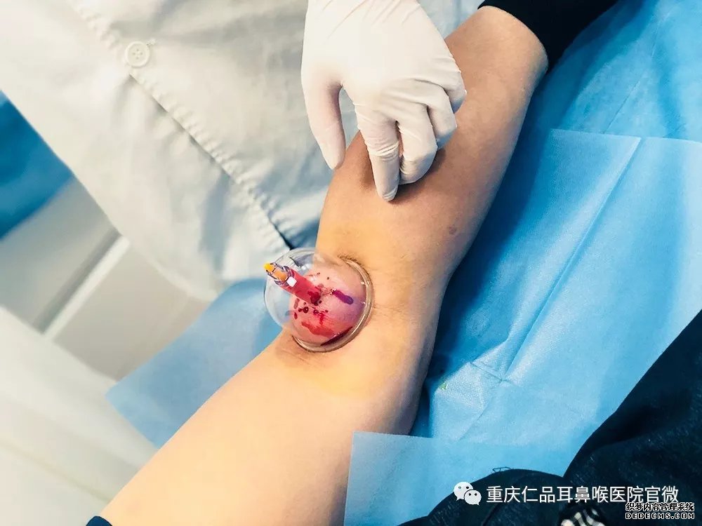 重庆仁品耳鼻喉医院