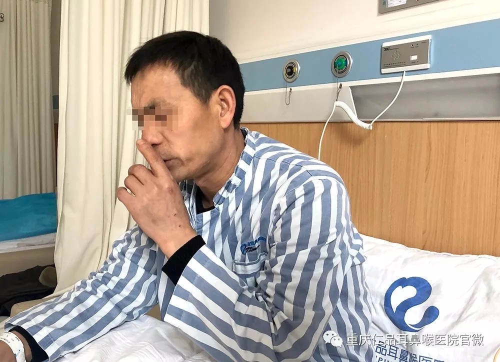 鼓膜穿孔