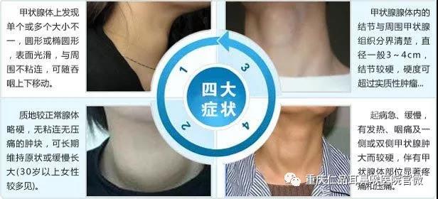 甲状腺