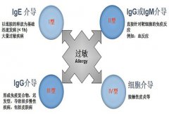 过敏性鼻炎的病因