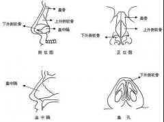 鼻息肉只是鼻子里多长块肉这么简单吗