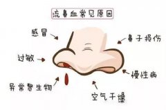 孩子鼻出血要注意了