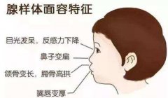 重庆耳鼻喉医院排名_腺样体肥大的护理方法