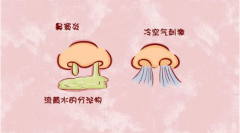 重庆耳鼻喉医院排名_鼻窦炎的具体症状有哪些