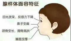 重庆仁品耳鼻喉医院-宝宝腺样体肥大该注意什么