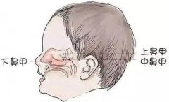 鼻甲肥大的常见症状-重庆耳鼻喉医院排名