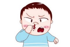 鼻出血有哪些常见症状？