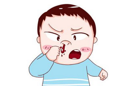 鼻出血的常见症状有哪些？