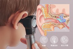 中耳炎是如何引起的,三种类型中耳炎的常见病因